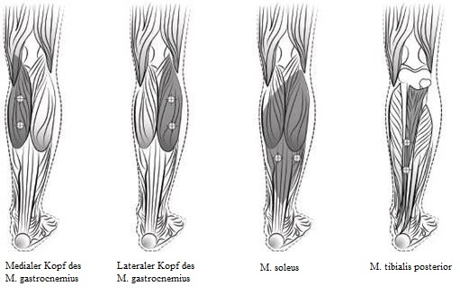 Picture 1