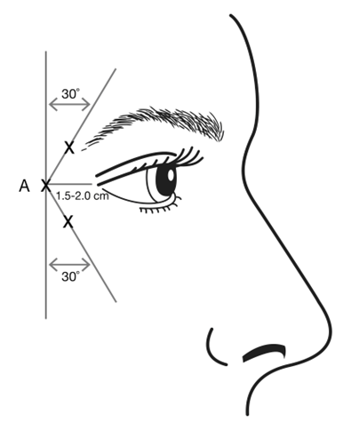 Grafik 4