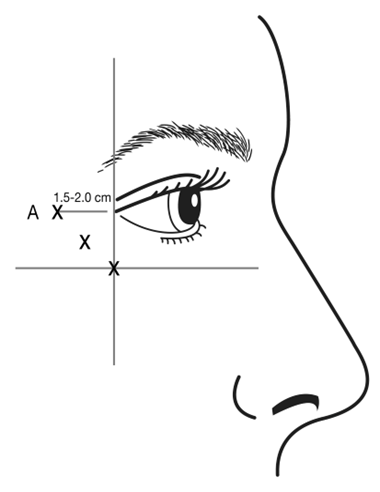 Grafik 3